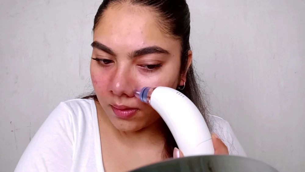 Derma Suction Blackhead Remover